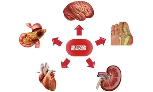 尿酸高有什么严重后果