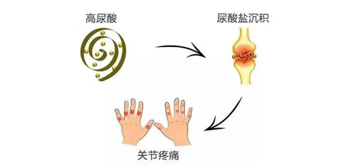 痛风怎么引起的？